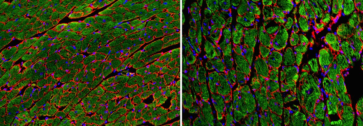 DNA damage & Heart disease
